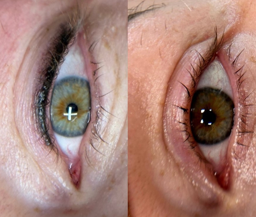 Eyeliner Tattoo Upper Lid