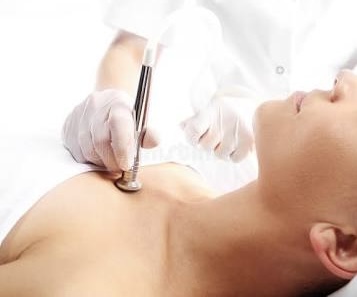 Body Microdermabrasion at Sóluna Aesthetics in Rochester, MN