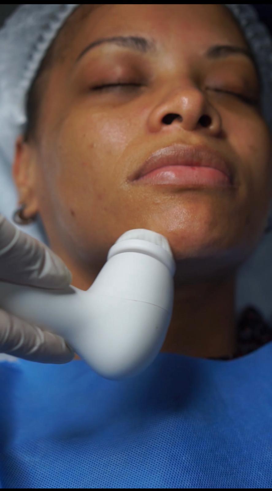 Deep facial cleansing