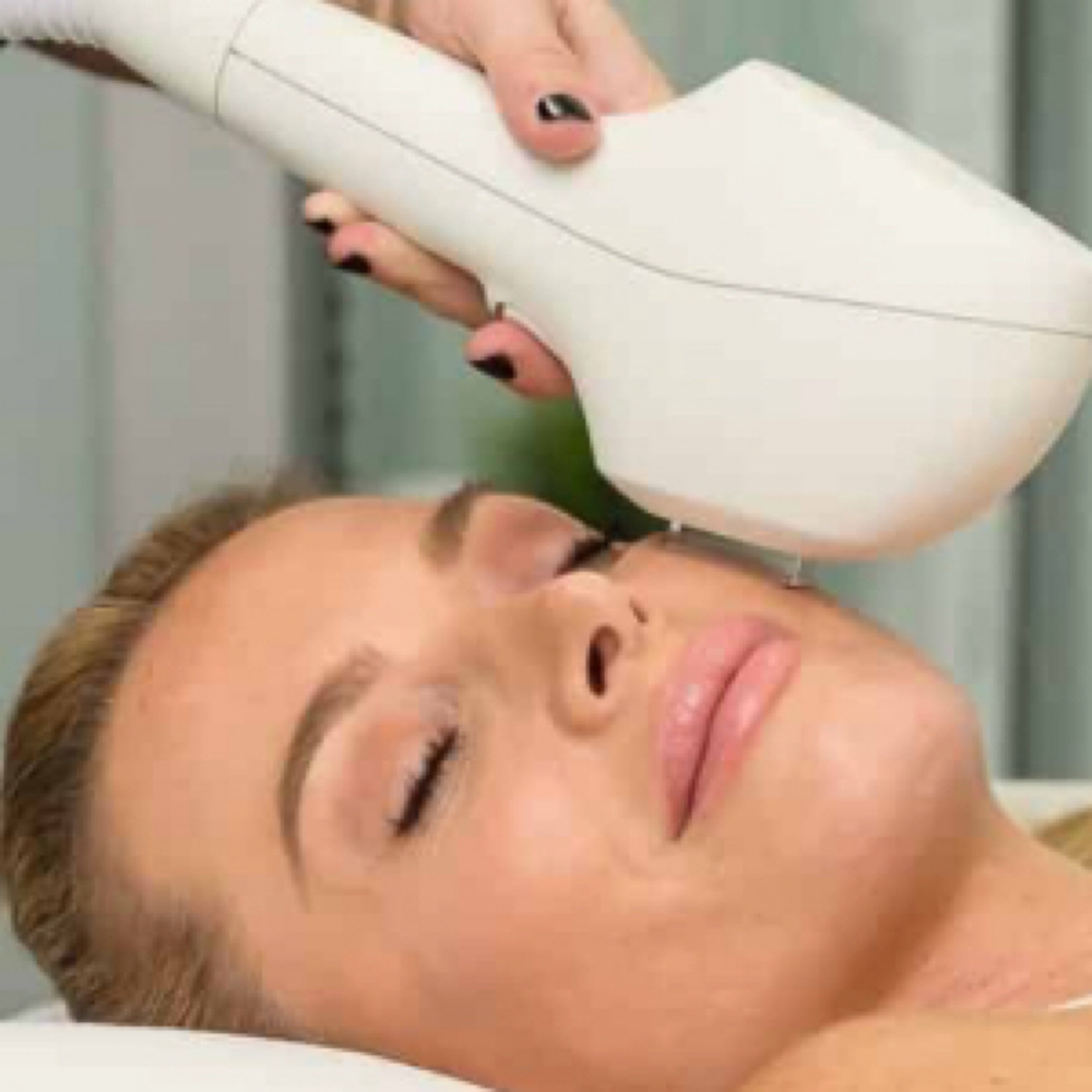 IPL PHOTO FACIAL at HOUSE OF BEAUTY UTAH in St George, UT