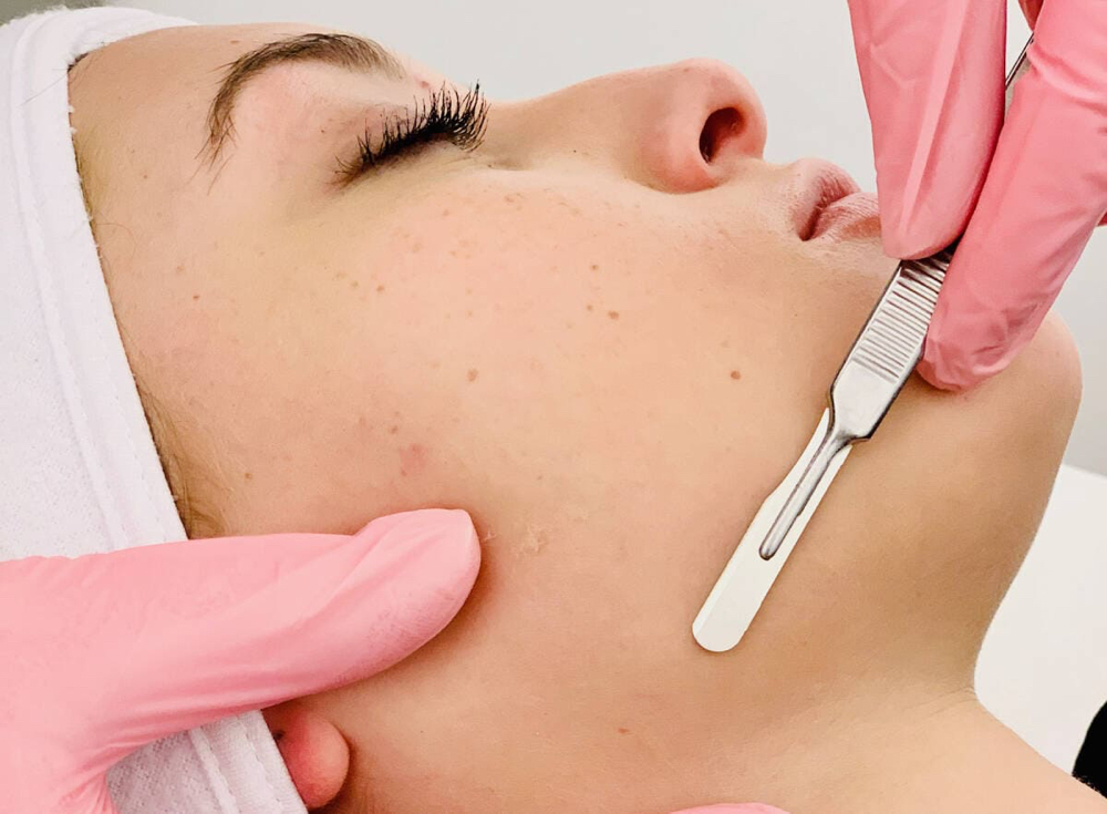 Dermaplaning Facial