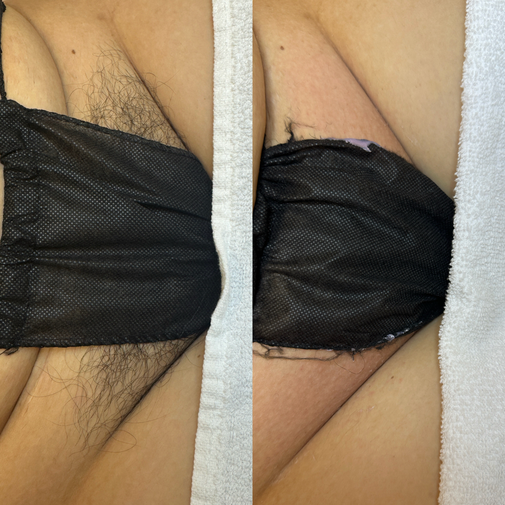 Bikini Wax