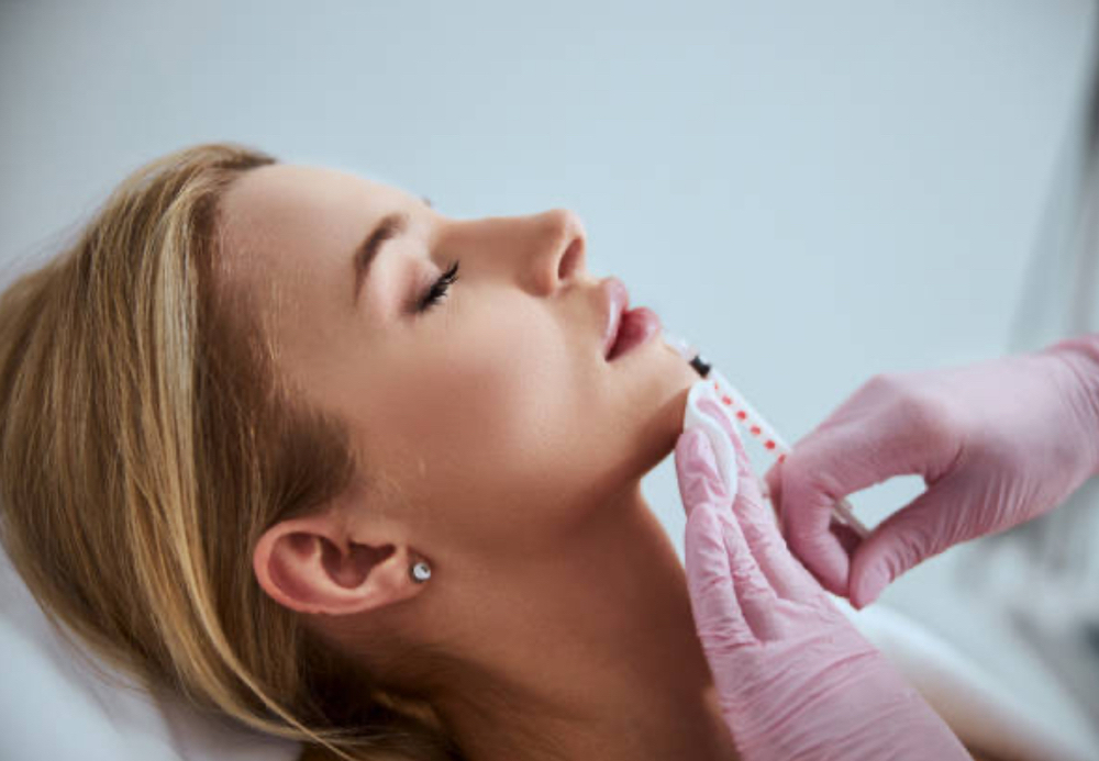 Dermal Filler