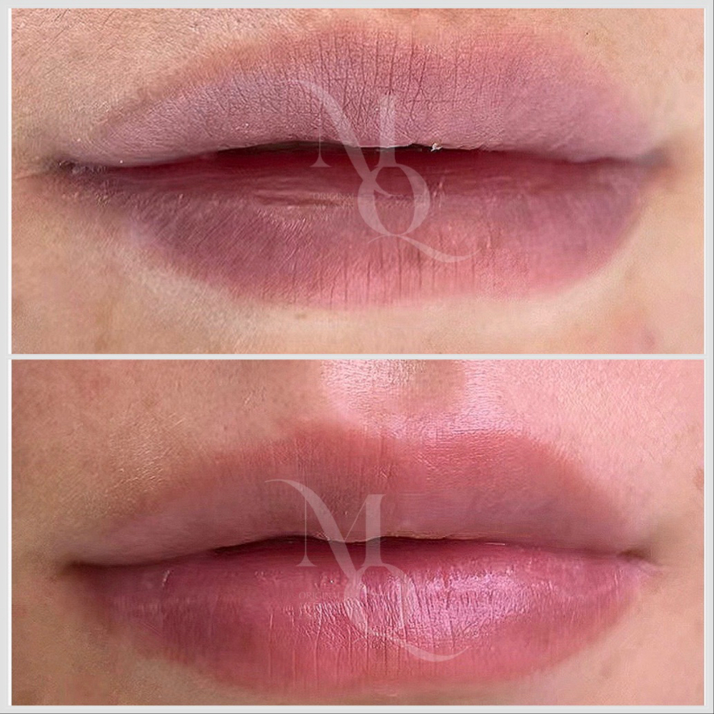 Lip Melanin Care at Ink Beauty Studio in McAllen, TX