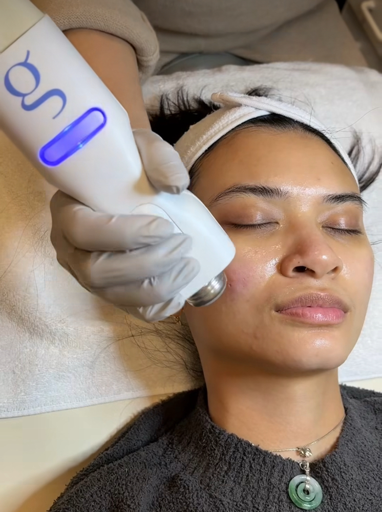 Glacial Glide Treatment