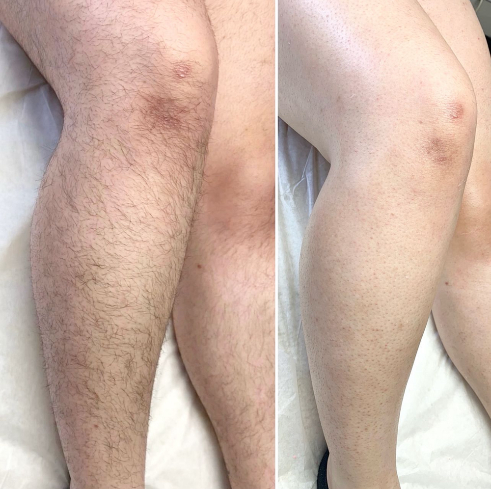 Full Legs Wax