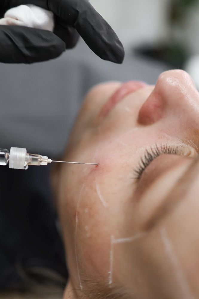 Dermal Filler