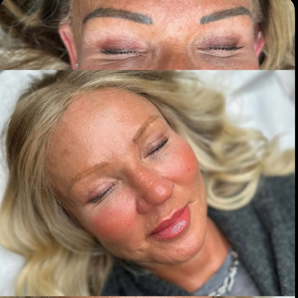 Saline eyebrows removal at Katie Beauty in Walnut Creek, CA
