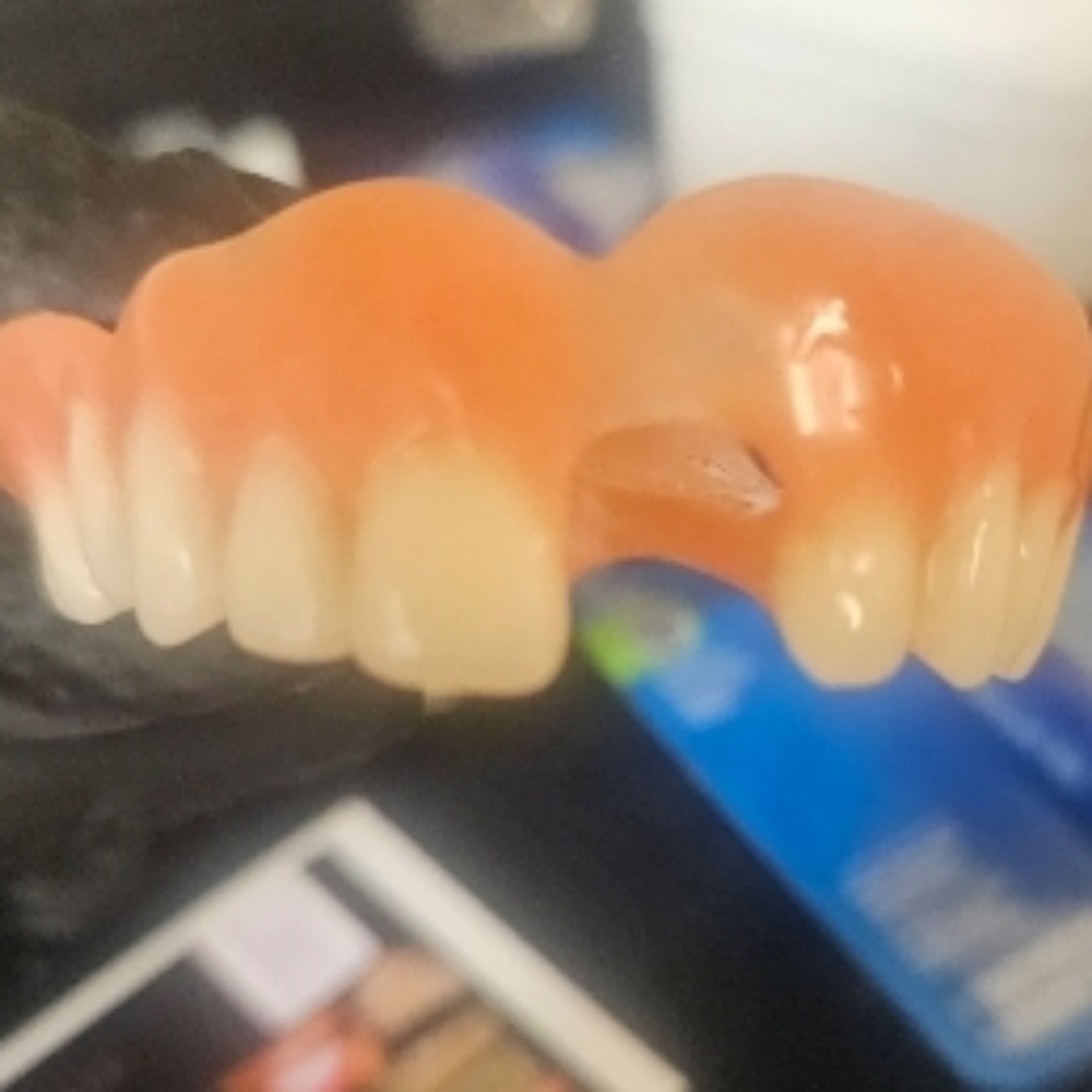 Full Denture at The Gold Standard in Indianapolis, IN