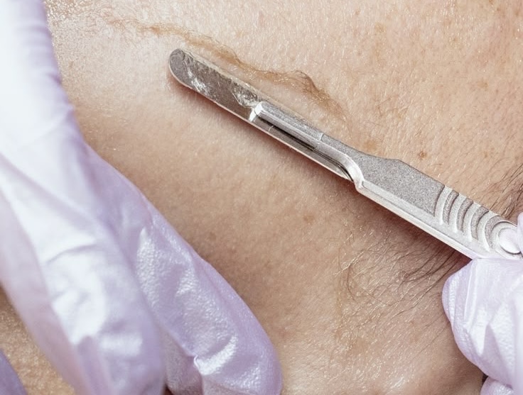 The Smooth Hour - Dermaplane Facial