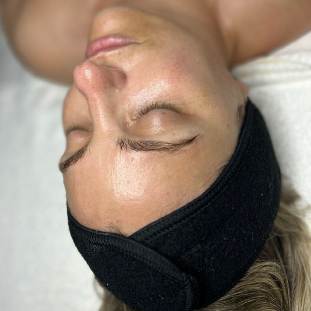 Age Delay Peel Facial at Dream Skin & Beauty in New York, NY