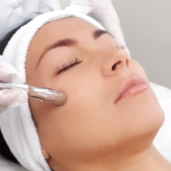 Skin Correction + Microdermabrasion at Fitzskin in Gilbert, AZ