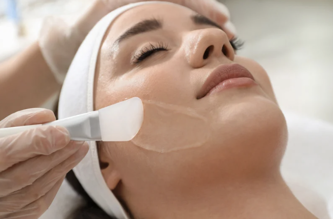Chemical Peels