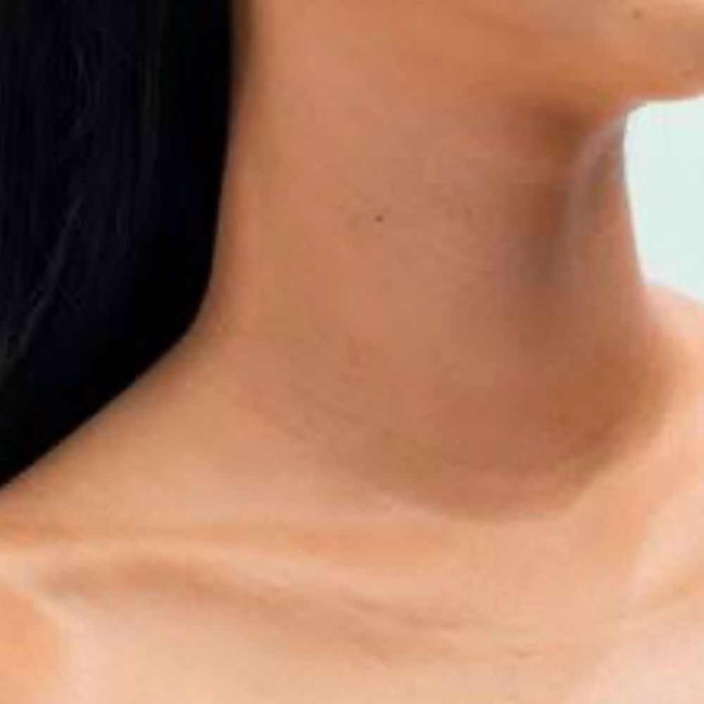 Micro-Infusion Neck & Décolleté at Aquariusfacialspa in Matthews, NC