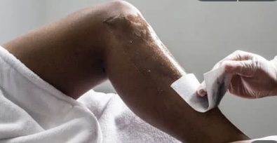 Full Leg at RYvive spa in West Jordan, UT