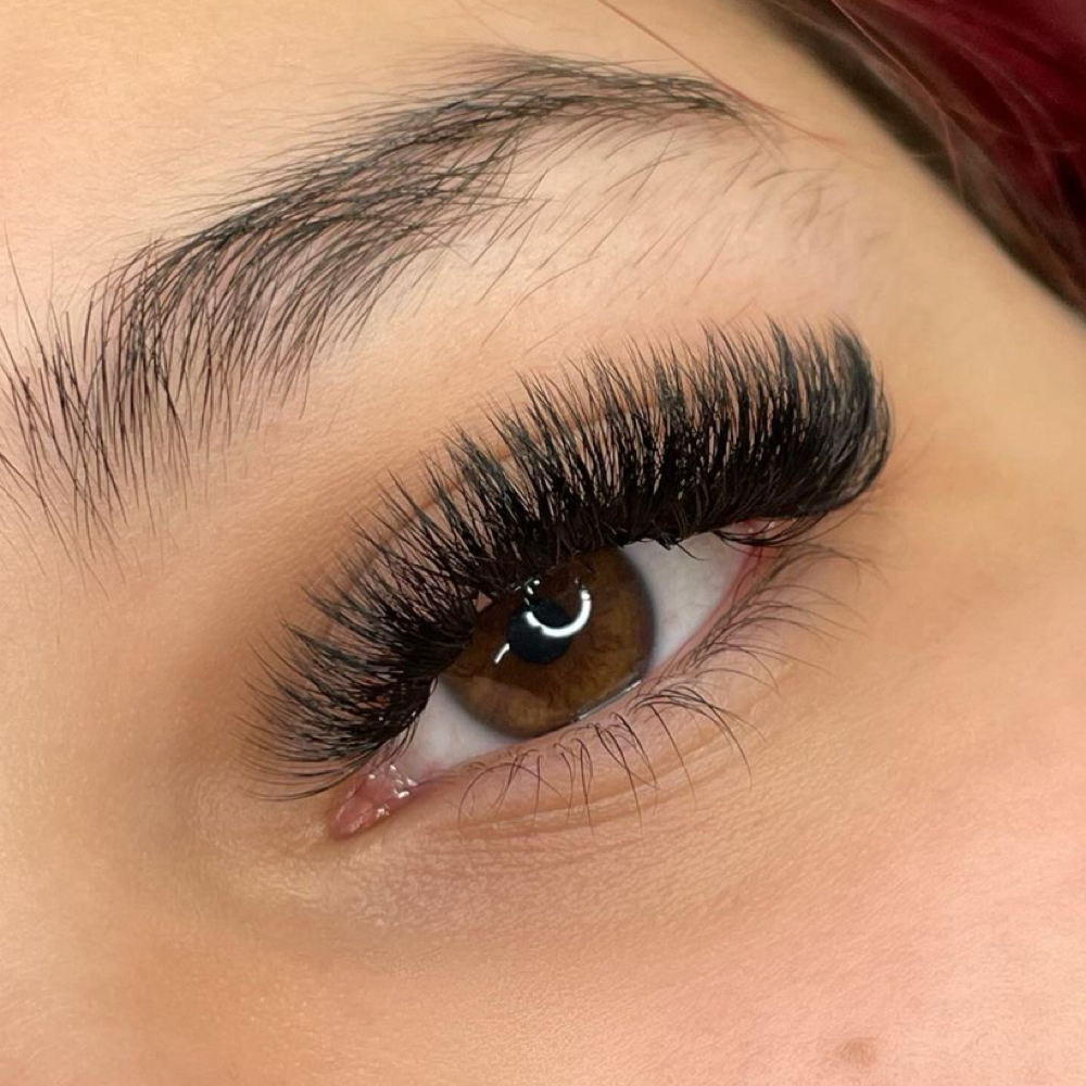 Volume 2 Week Fill at Nude Skin Aesthetics in San Pedro, CA
