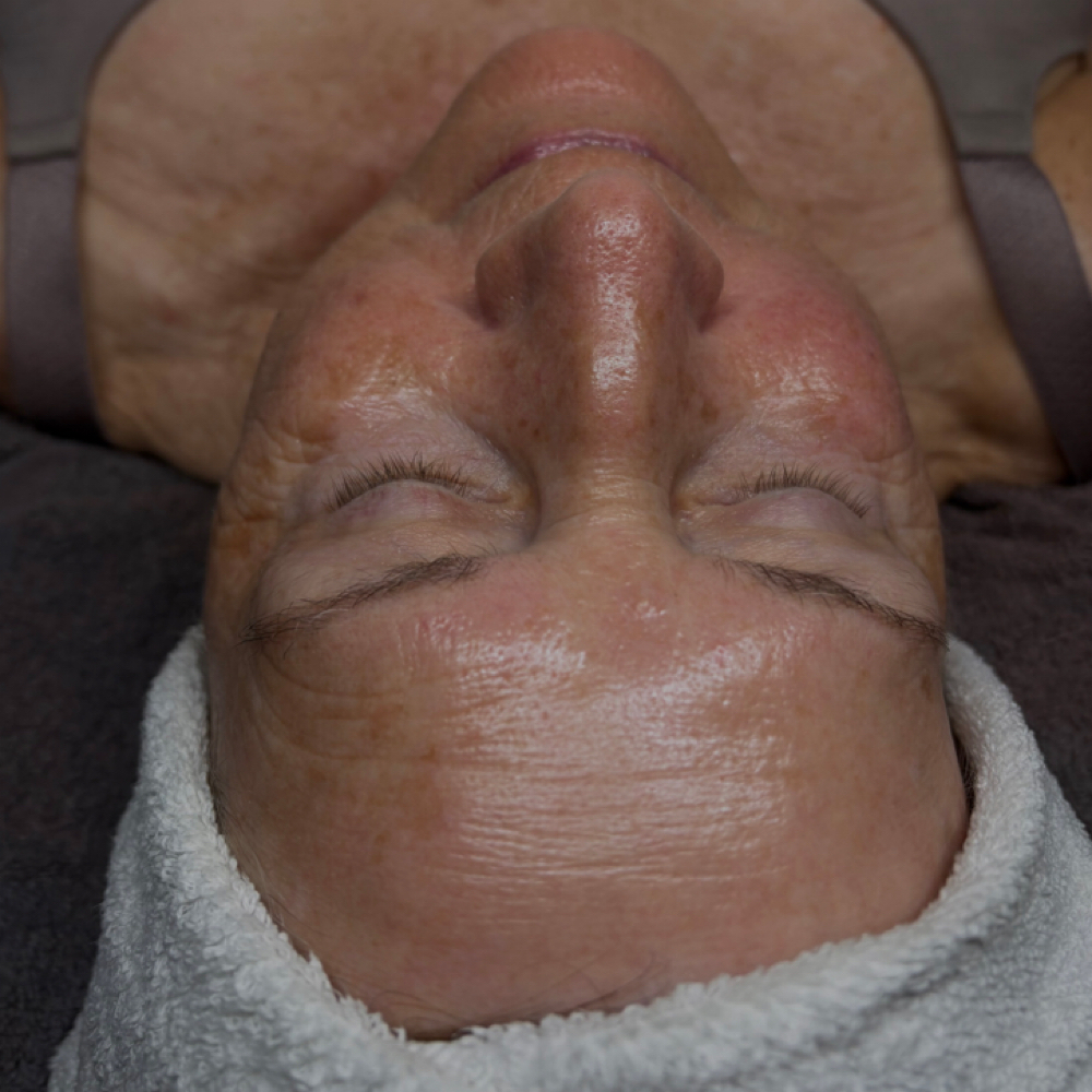 Youth Infusion| Advanced Anti-Aging at True Aura Wellness and Skin LLC in Lees Summit, MO