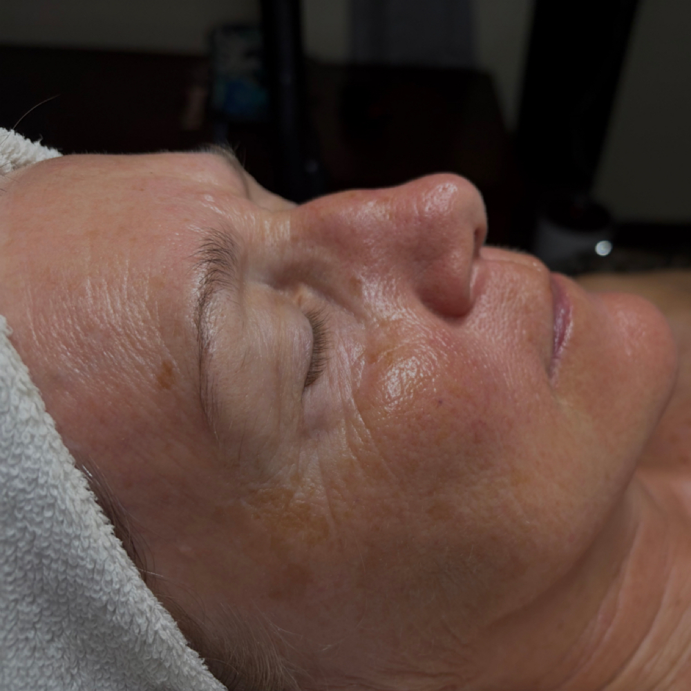 Youth Infusion| Advanced Anti-Aging at True Aura Wellness and Skin LLC in Lees Summit, MO
