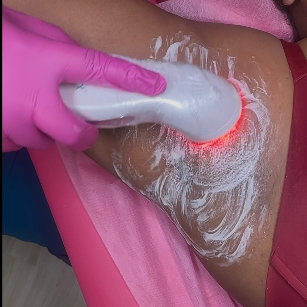 Underarm Detox
