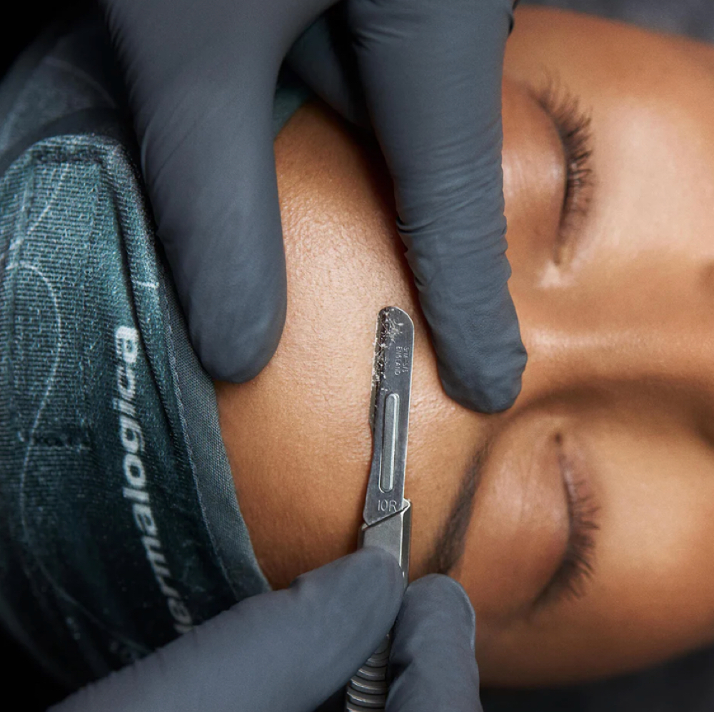dermaplaning Facial at Nina Beauty&Brows Studio in North Hollywood, CA