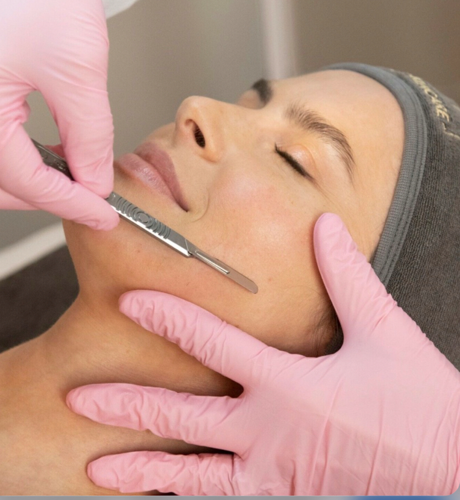 Dermaplaning Treatment
