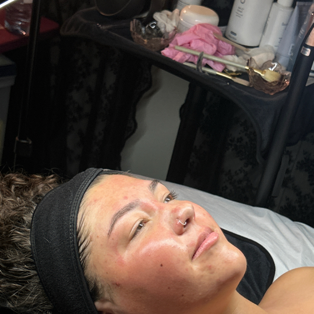 Acne Consult And Custom Facial at Not the Body Shop in Littleton, CO