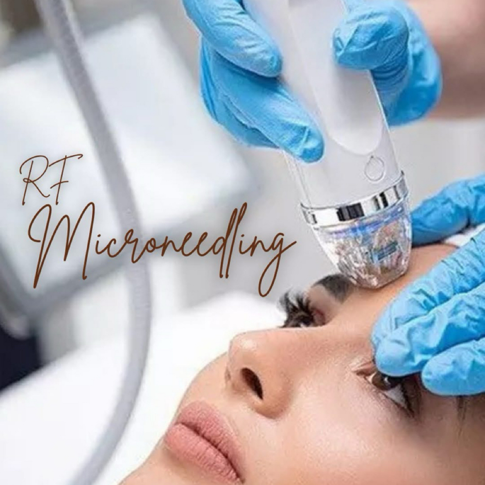Microneedling RF at ARock Beauty & Wellness in San Angelo, TX
