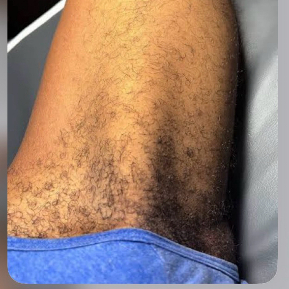 BB Inner Thigh Wax at BOND BEAUTY STUDIO, LLC in Clifton, NJ