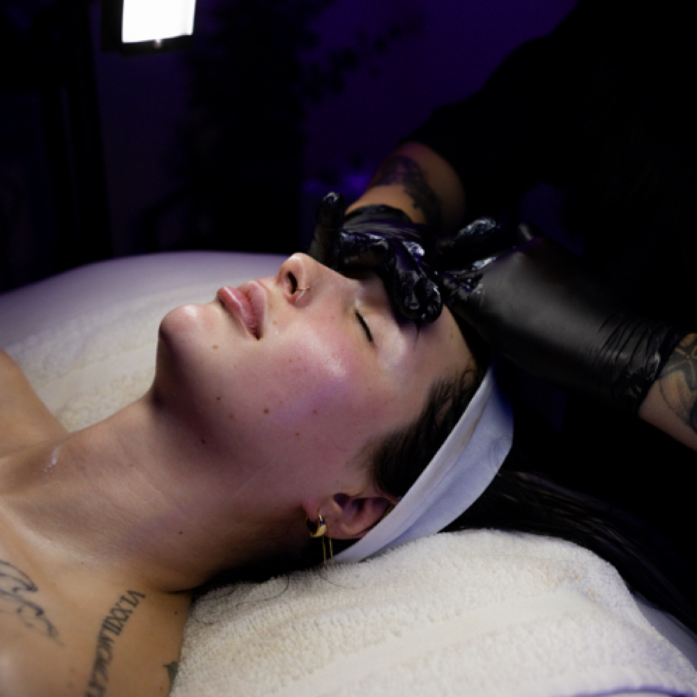 Jessner Peel at Happy Skin Co. in Macomb, MI