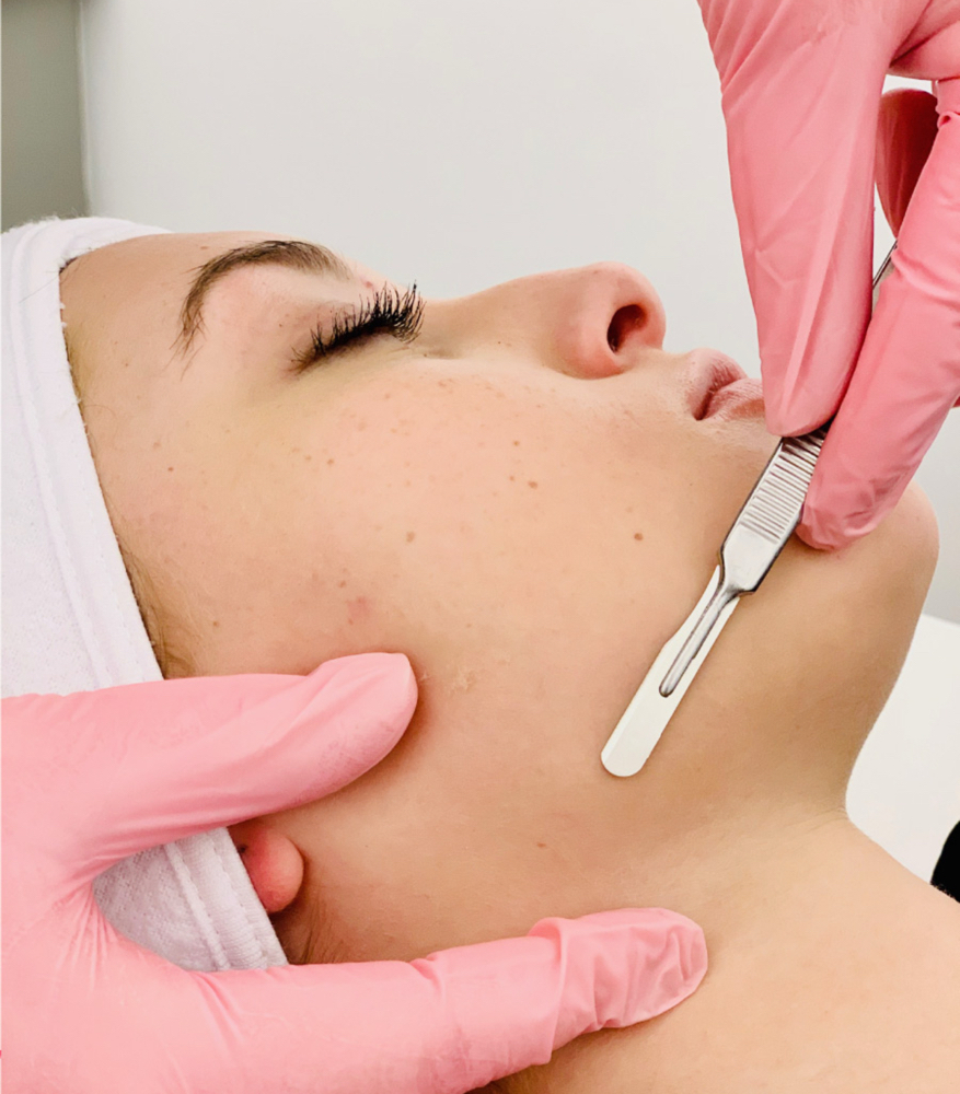 Dermaplane Facial