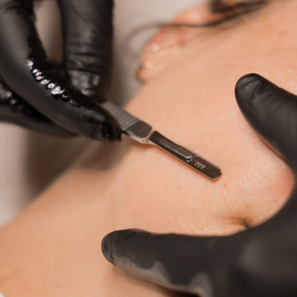 Dermaplane Facial