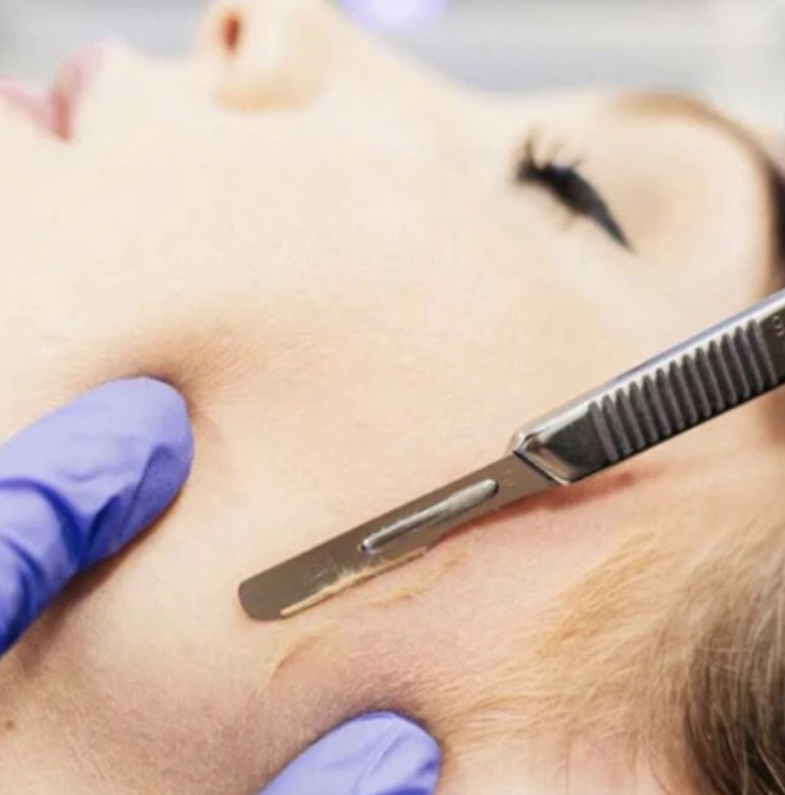 Dermaplane Facial