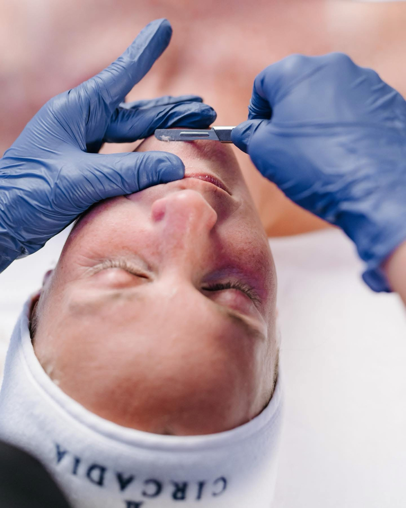 Dermaplane Facial (Coming Soon)