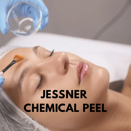 Jessner Chemical Peel