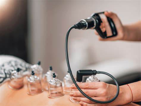 Cupping Therapy