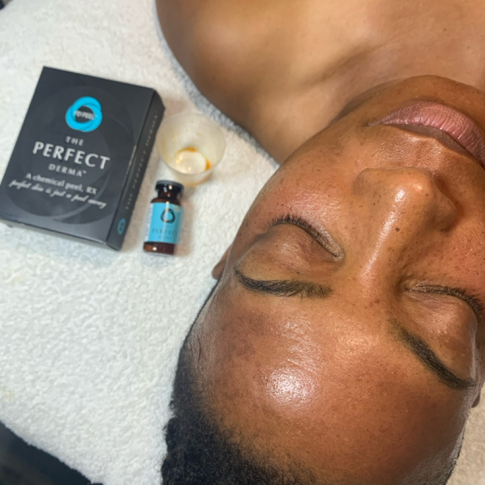 Perfect Derma Peel at Millennium Day Spa in Inglewood, CA