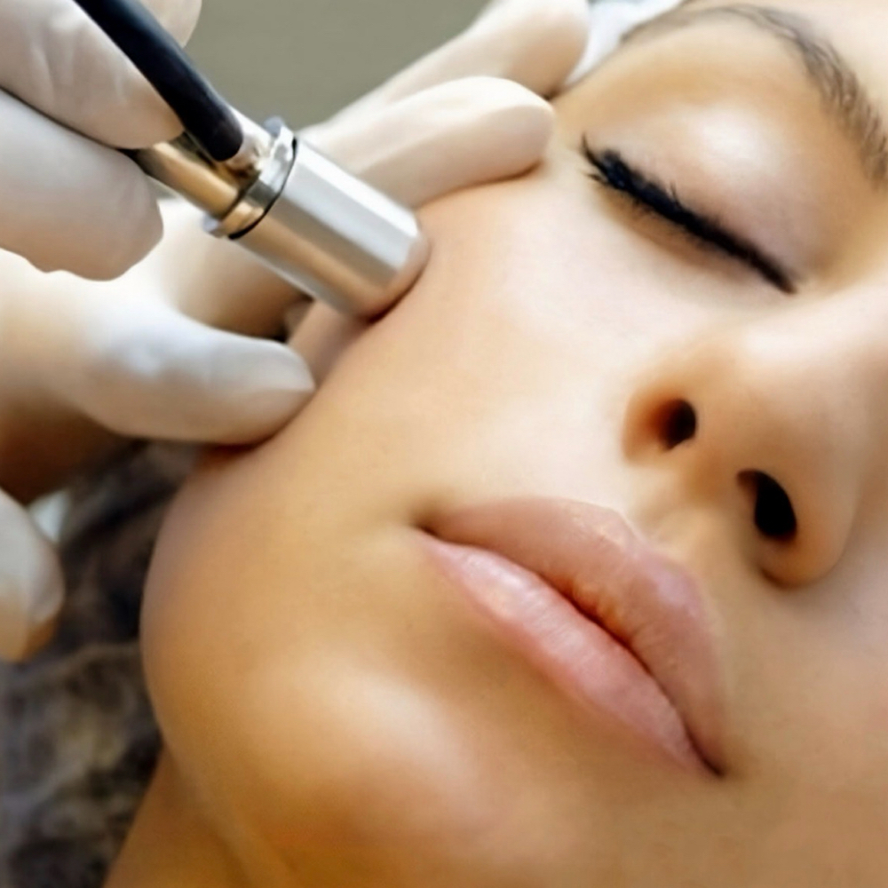 Microdermabrasion Add On at Thehoustonfacebar in Houston, TX
