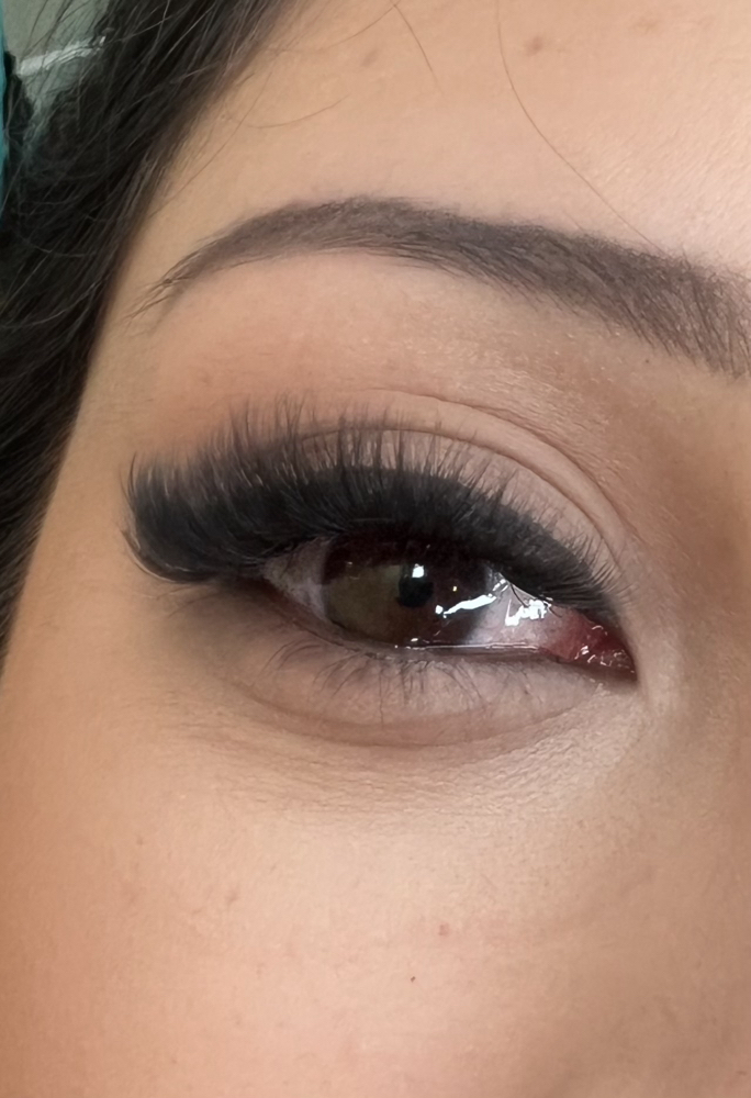 3 Week Volume Fill