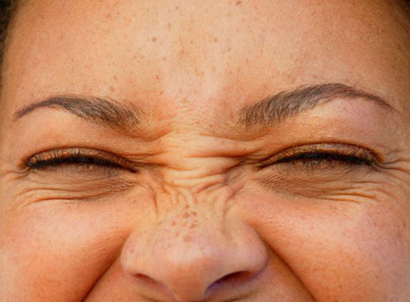 Bunny Lines (Nose)