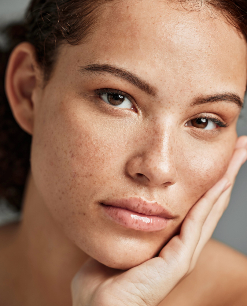 Collagen Induction Therapy
