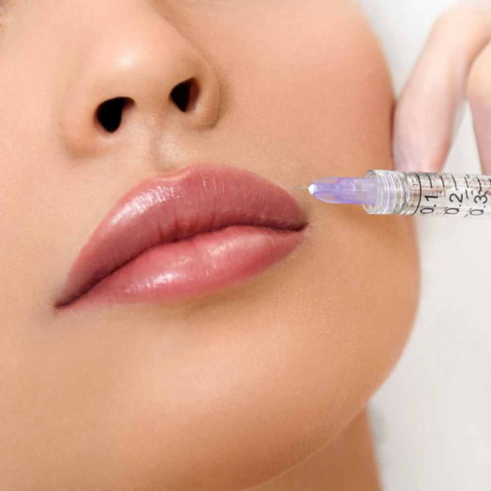 Lip Filler Dissolving at SOL SKN Aesthetics in Franklin, TN