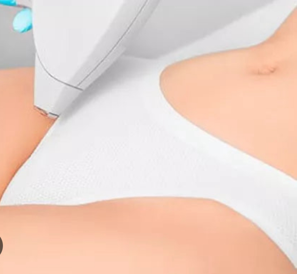 Bikini Line- Laser Hair Removal