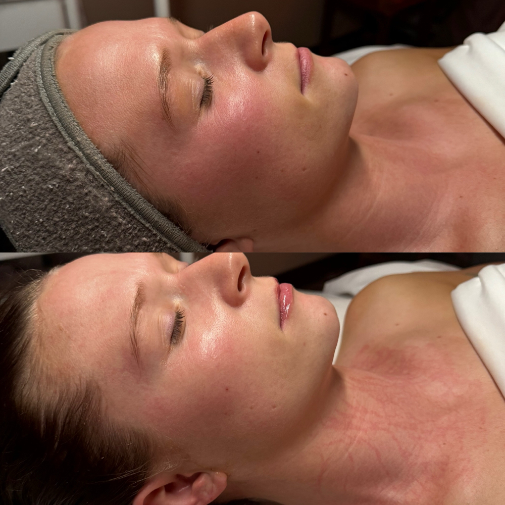 Luxe Lift Facial