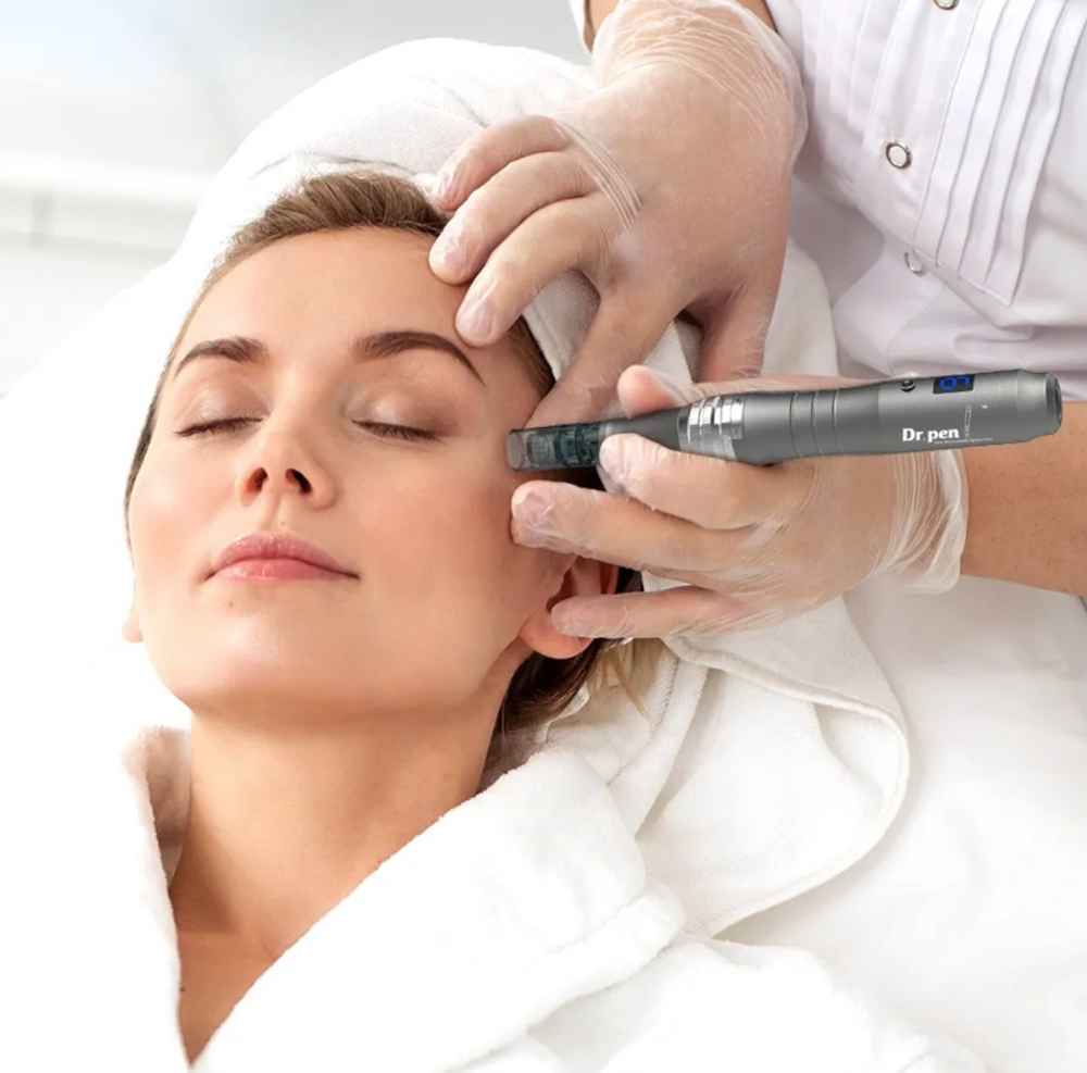 Microneedling