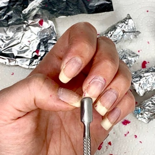 NO-CHIP REMOVER at Skin Room in Chicago, IL