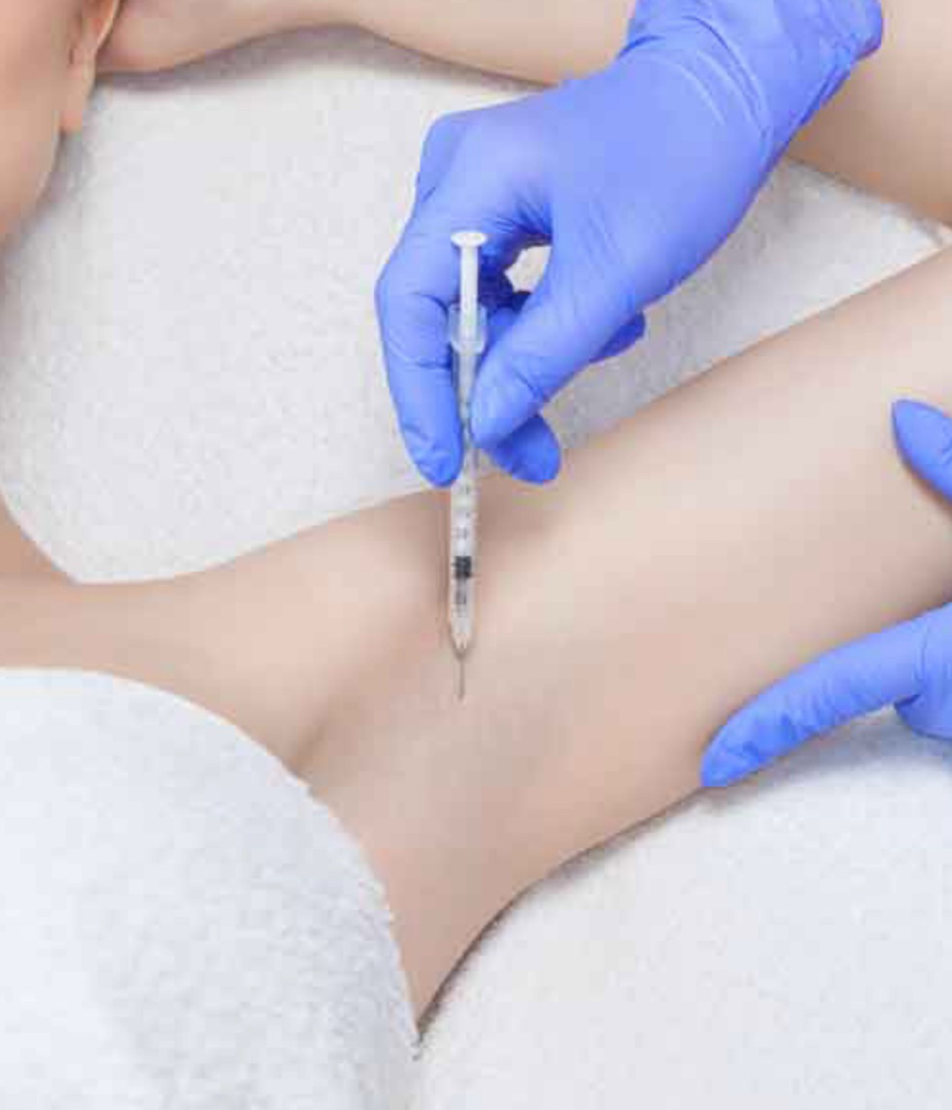 Botox For Excessive Sweating