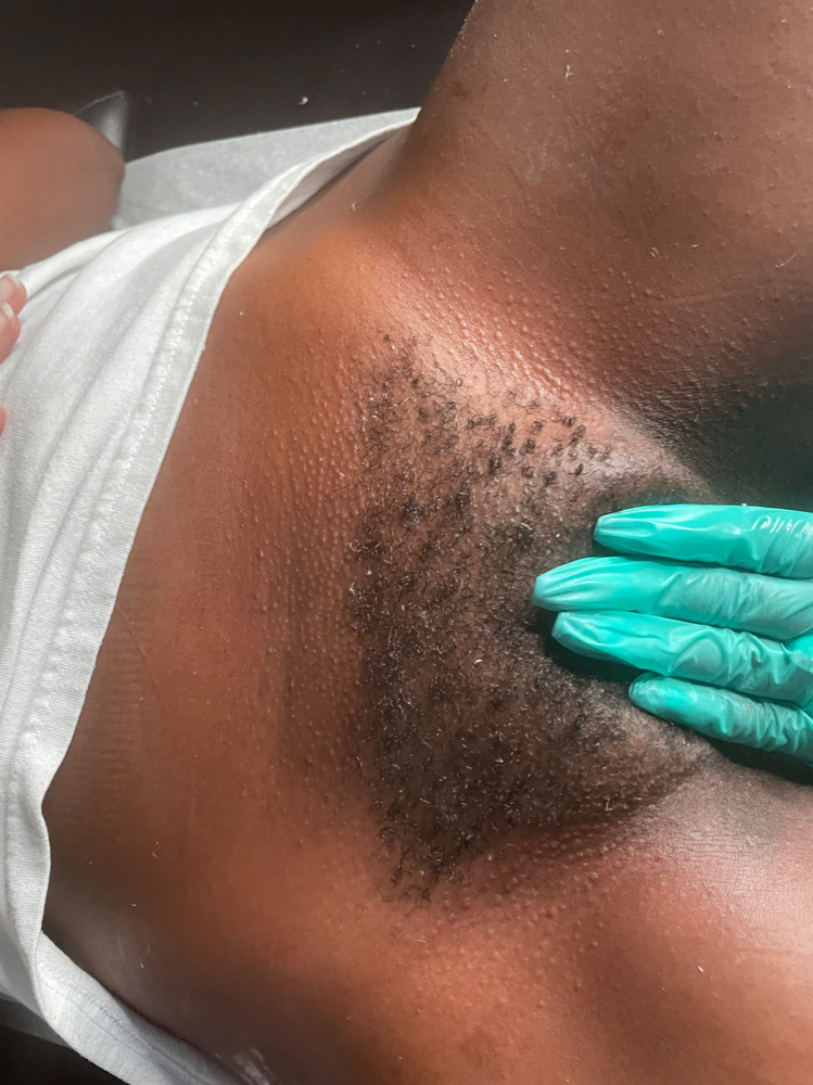 Bikini Line Wax