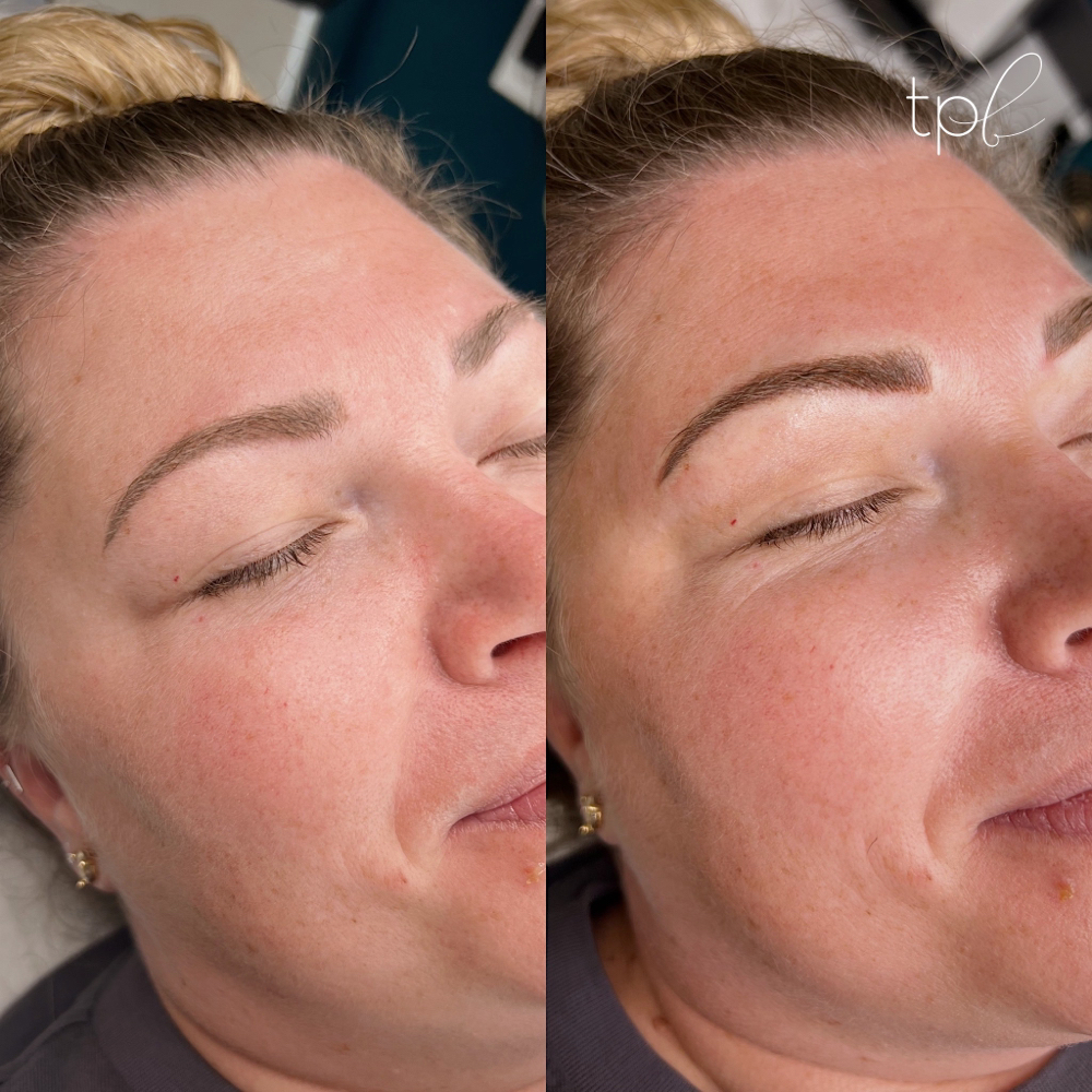 Previous PMU Microblading Service