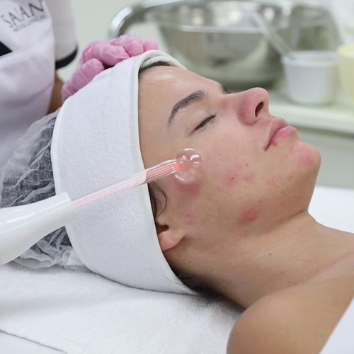 Acne Clearing Facial