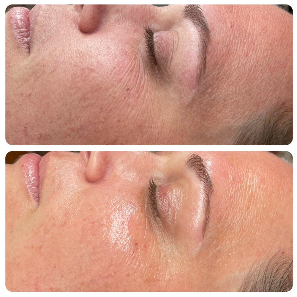 KOREAN GLASS SKIN FACIAL at Amy Shafer Aesthetics in Nashville, TN